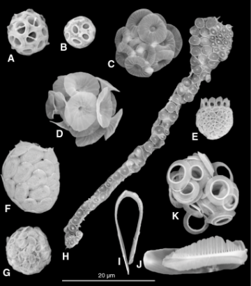 Coccolithophore_samples_from_the_Maldives
